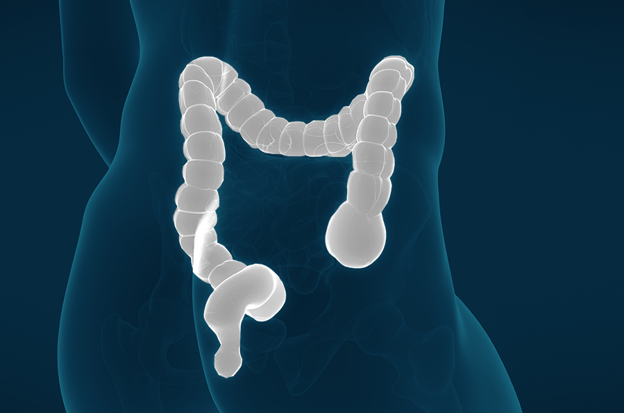 Colorectal Surgery | Surgical Associates